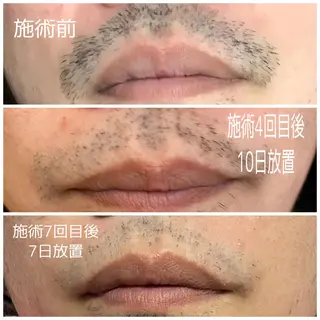 伊藤 絵美のエステ・リラクイメージ