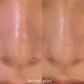 渋谷ベルゼ🌷木下 毛穴/脱毛/フェムのその他イメージ