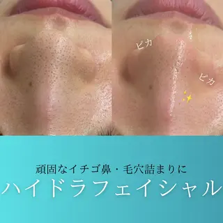 Glanz Beauty所属・Glanz Beautyの眉毛・アイブロウイメージ