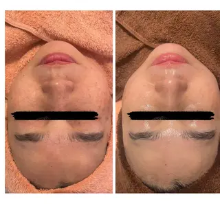 エムフルール リラク＆エステのエステ・リラクイメージ