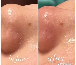 💚THE BALM 金子💚✨のエステ・リラクイメージ