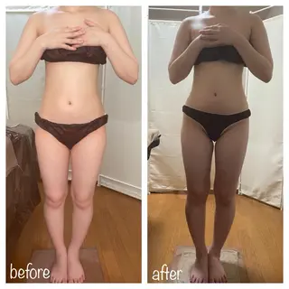 biloop所属・《痩身×疲労改善》 BILOOPのエステ・リラクイメージ