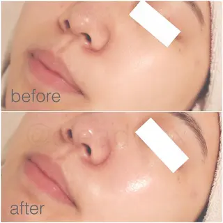 CLEAD 赤坂見附店のエステ・リラクイメージ