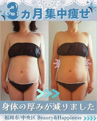 痩身ハーブピーリング 筋膜リリース☆B&Hのエステ・リラクイメージ