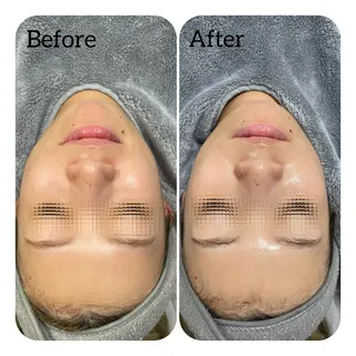 Éclat de Belle🫧白玉肌のエステ・リラクイメージ