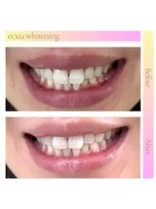 セルフホワイトニング エクシア西宮北口店所属・セルフホワイトニング エクシア西宮北口店のその他イメージ