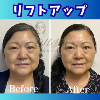 💎小顔サロン アリリン銀座💎のエステ・リラクイメージ