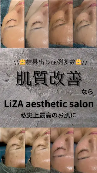 LiZA エステティックサロンのエステ・リラクイメージ