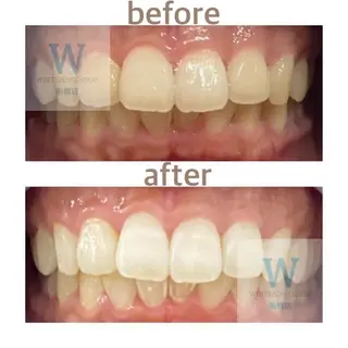 ホワイトニング ショップ船橋店🦷のエステ・リラクイメージ