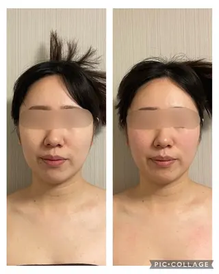 SOLUNA目黒店所属・小顔/毛穴洗浄/痩身 ayako🌿のエステ・リラクイメージ