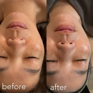 エステティックサロン Liente(リアンテ)所属・Hashimoto .のエステ・リラクイメージ