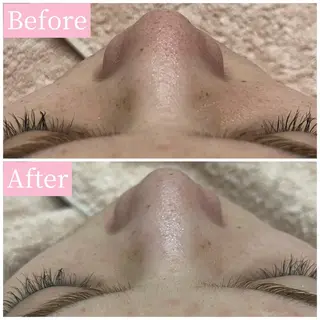 ハーブピーリング専門 muro.のエステ・リラクイメージ