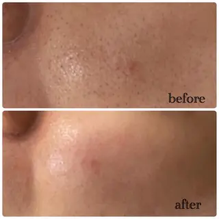 デ・アイム新潟北所属・サイトウ .のエステ・リラクイメージ