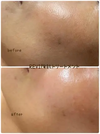 eye lash Lapisのマツエク・マツパデザイン