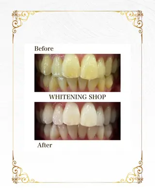 ホワイトニングショップ静岡葵区店所属・ホワイトニング ショップ葵区静岡駅店のその他イメージ