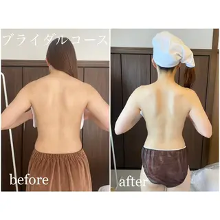 I'm -ｲﾑ-所属・肌質改善／ブライダル I'm.-イム-のエステ・リラクイメージ