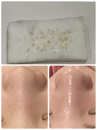 【リベルハーブピーリング認定店】敏感肌・美白脱毛専門店Dione立川店所属・Dione 立川店のエステ・リラクイメージ