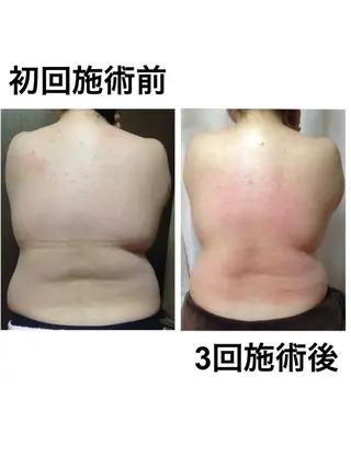 Lussera(ルセラ)所属・肌質を変えて すっぴん肌に✨のその他イメージ