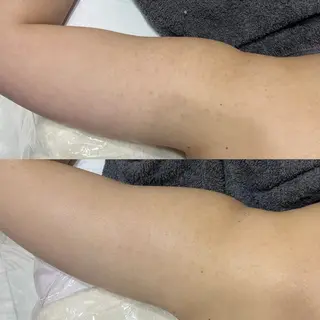 ๐๐๐๐ก๐ ๐๐ฒ ๐๐๐ฒ๐ฎๆๅฑใปใใผใใใผใชใณใฐ๐ฟ ๐ด๐๐๐ใฎใจในใใปใชใฉใฏใคใกใผใธ