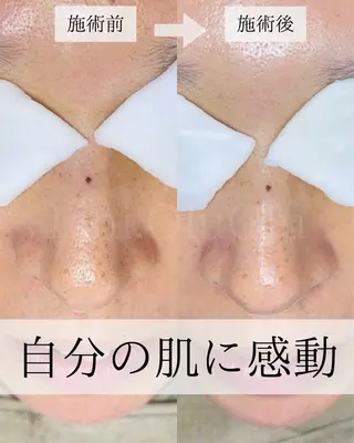 毛穴汚れ改善専門店/ 岸和田/リヒオルオルのエステ・リラクイメージ