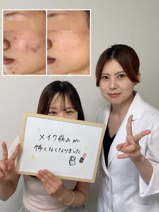 ニキビ・ 肌荒れ専門店のエステ・リラクイメージ