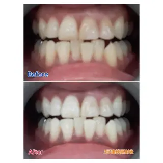 M渋谷店所属・Ｍ渋谷 ホワイトニングのその他イメージ