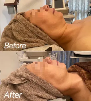 Remina clinical salon所属・ハイフ美肌専門 Remina.c.sのエステ・リラクイメージ