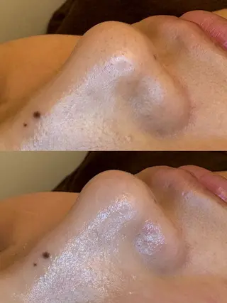 EARTH coiffure beaute 新潟紫竹山店所属・🤍アベシュリ /フェイシャル🤍のエステ・リラクイメージ