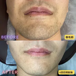 メンズ 都度払い専門　脱毛サロンHYGIENE BEAUTY ROOM 19B 仙台駅前東口店所属・脱毛サロン 19B(毛利)のエステ・リラクイメージ