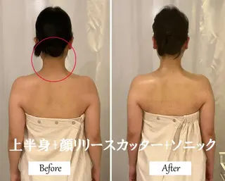 ブライダルサロン ｜Lino【堀江】のエステ・リラクイメージ