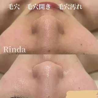 ブライダル痩身×脱毛 尼崎駅前サロンのエステ・リラクイメージ