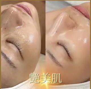 メンズ マツエク・マツパ salonLADYSTYLE所属・稲嶺 美華のエステ・リラクイメージ