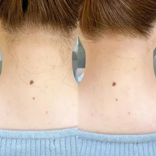 ネイル マツエク・マツパ アイブロウ Grace naoのマツエク・マツパデザイン