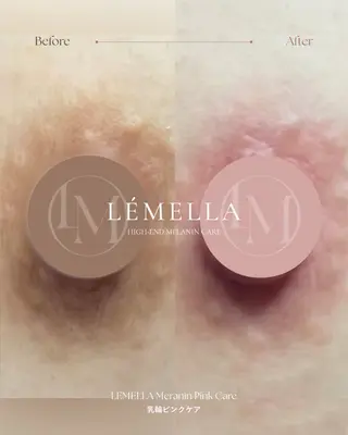 Chel チェルのその他イメージ