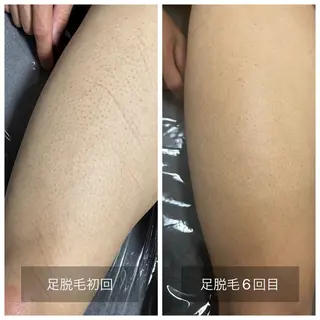 メンズ エマニエル USAのエステ・リラクイメージ