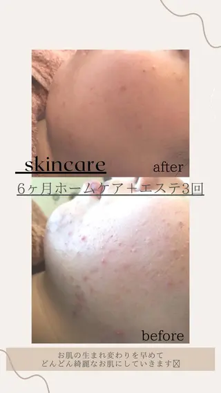 KOHAKU.所属・Nana Kikutaのエステ・リラクイメージ