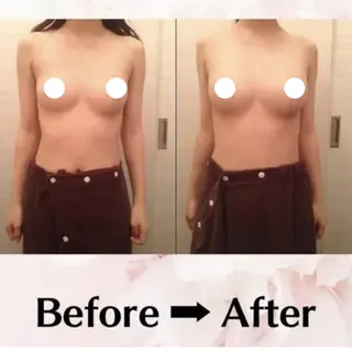 バスト・脱毛・痩身 上島のエステ・リラクイメージ