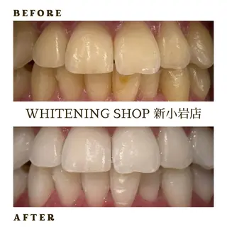 メンズ ホワイトニング ショップ新小岩店のその他イメージ