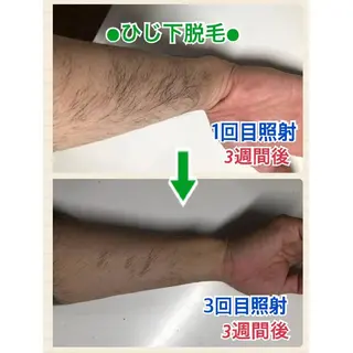 メンズ キッズ メンズ脱毛サロンBiSTA所属・BiSTA ヒロのエステ・リラクイメージ