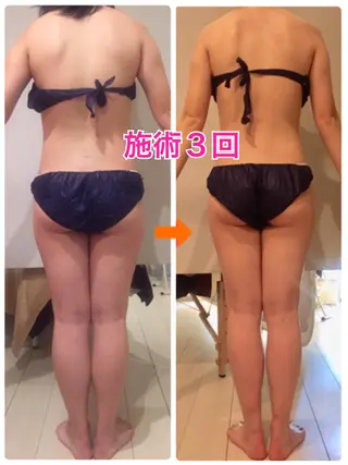 ロング カラー パーマ ヘアアレンジ メンズ キッズ ネイル マツエク・マツパ ‍痩身＆ボディ 結果出し🌟丹野のエステ・リラクイメージ