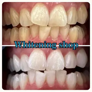 ホワイトニング ショップ吉祥寺店のエステ・リラクイメージ