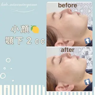 小顔痩身HALO 二宮早織のエステ・リラクイメージ