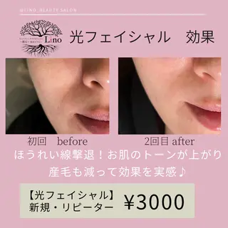 キッズ ネイル マツエク・マツパ Lino 《リノ》のエステ・リラクイメージ