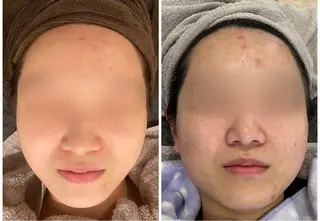 エステティックジュビランアンビエンテ福井店所属・ジュビラン 木村 紗也香のエステ・リラクイメージ