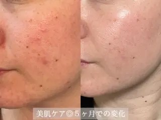 salon ditto所属・mio (小顔・ヘッドスパ)のエステ・リラクイメージ