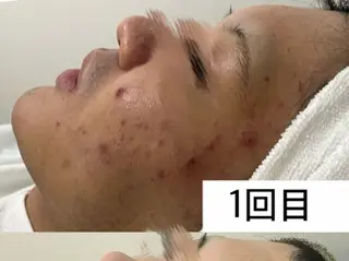 メンズ 韓国肌管理Belle 神戸元町のエステ・リラクイメージ