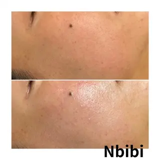 韓国🇰🇷価格 サロン_Nbibiのエステ・リラクイメージ