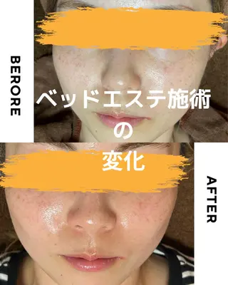 LaLa heal デアイム甲府南店所属・デアイム もえかのエステ・リラクイメージ