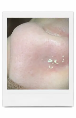 Rifuro毛穴ケア &よもぎ蒸しサロンのエステ・リラクイメージ