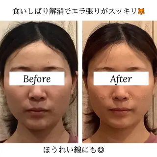 渋谷小顔矯正 毛穴洗浄ウミのエステ・リラクイメージ